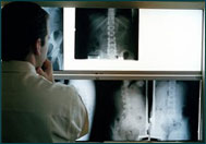 Hip Replacement Hospital In Delhi, Hip Replacement Hospital In Chennai, Hip Replacement Hospital In Kolkata